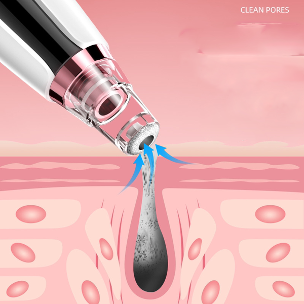 Συσκευή με κενό για τον καθαρισμό του προσώπου και των σπυρακιών