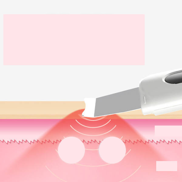 Ultraskaņas iekārta, jonoforēze melno punktu pīlingam un tīrīšanai