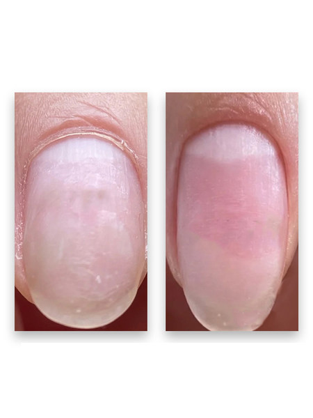 Επαγγελματικό εργαλείο κοπής νεκρού δέρματος