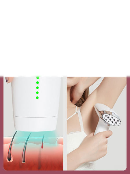 Aparatas viso kūno plaukų šalinimui lazeriu